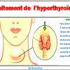 Traitement de L'Hyperthyroïdie - 100% Naturel